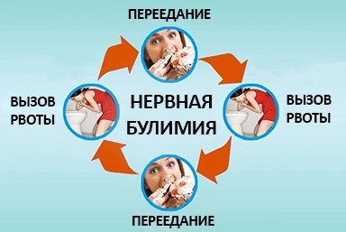 Лечение булимии в Сыктывкаре